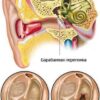 Операция на ухо восстановление слуха